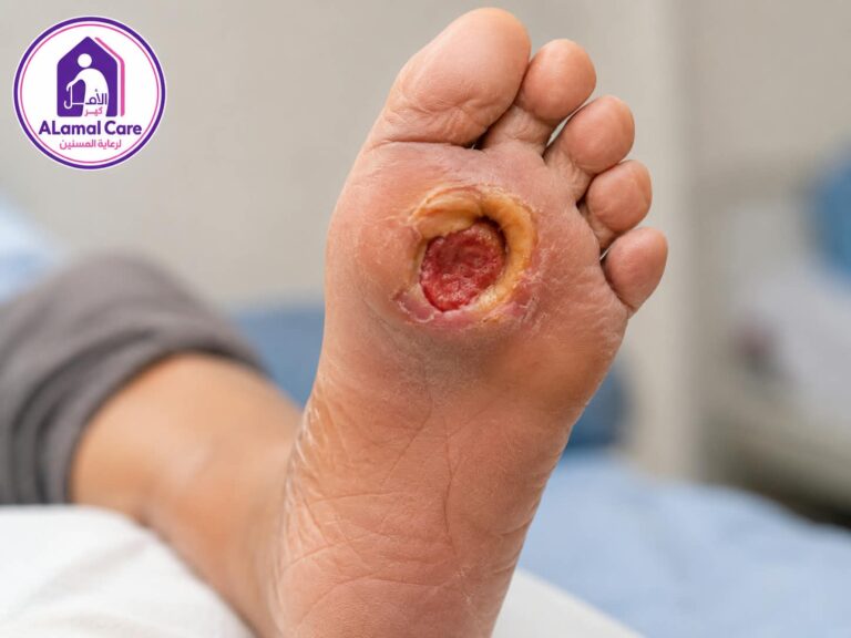 رعاية القدم السكري في دار الأمل